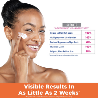 Palmer’s Skin Success Anti-Dark Spot Fade Cream for Oily Skin 75g | Niacinamide Care