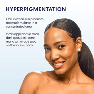 Palmer’s Skin Success Anti-Dark Spot Fade Milk 250ml | Tone Correcting Body Lotion