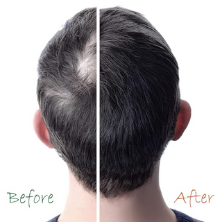 Original Hair Energizer Hair Booster With Vitamin-B5 6oz | Hair Repair & Damaged