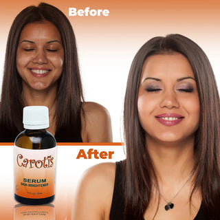 Carotis brightening serum improves skin tone and glow for smooth radiant skin