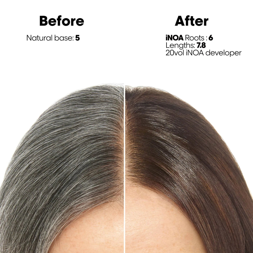 L’Oréal Professionnel INOA Oxydant Developer 3% 10 Vol 1000ml ammonia-free professional color developer for gentle salon hair coloring results.