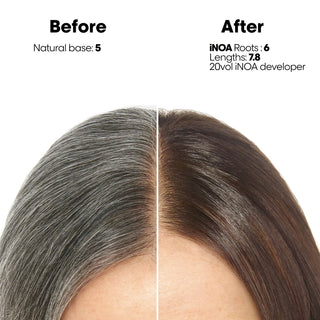 L’Oréal Professionnel INOA Oxydant Developer 3% 10 Vol 1000ml ammonia-free professional color developer for gentle salon hair coloring results.