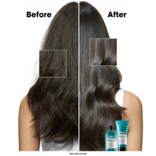 L’Oréal Professionnel Serie Expert Scalp Advanced Anti-Discomfort Shampoo 500ml for sensitive scalp care, hydration, and soothing professional cleansing.
