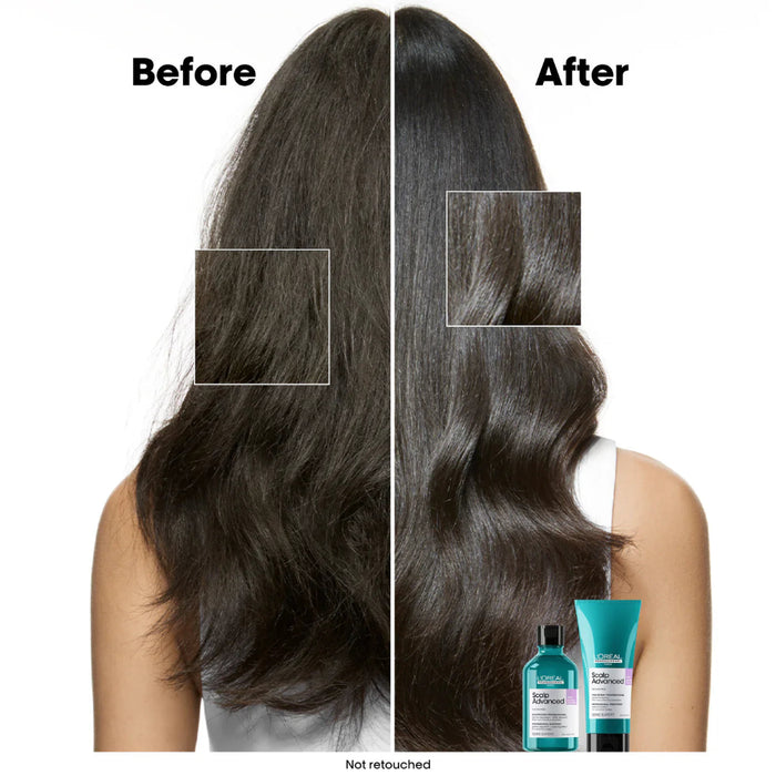 L'Oréal Professionnel Scalp Advanced Anti-Discomfort Shampoo 500ml | Scalp Care