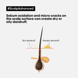 L’Oréal Professionnel Serie Expert Scalp Advanced Anti-Dandruff Dermo-Clarifier Shampoo 1500ml for dandruff control, scalp purification, and professional scalp care.