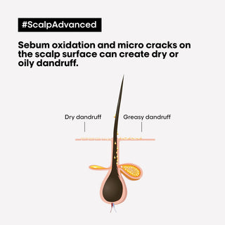 L’Oréal Professionnel Serie Expert Scalp Advanced Anti-Dandruff Dermo-Clarifier Shampoo 300ml for dandruff control, scalp purification, and professional scalp care.