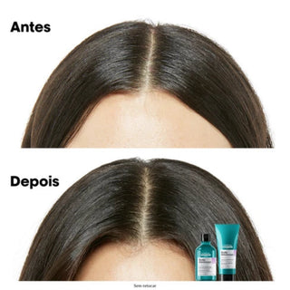 L’Oréal Professionnel Serie Expert Scalp Advanced Anti-Discomfort Shampoo 300ml for sensitive scalp care, hydration, and soothing comfort.