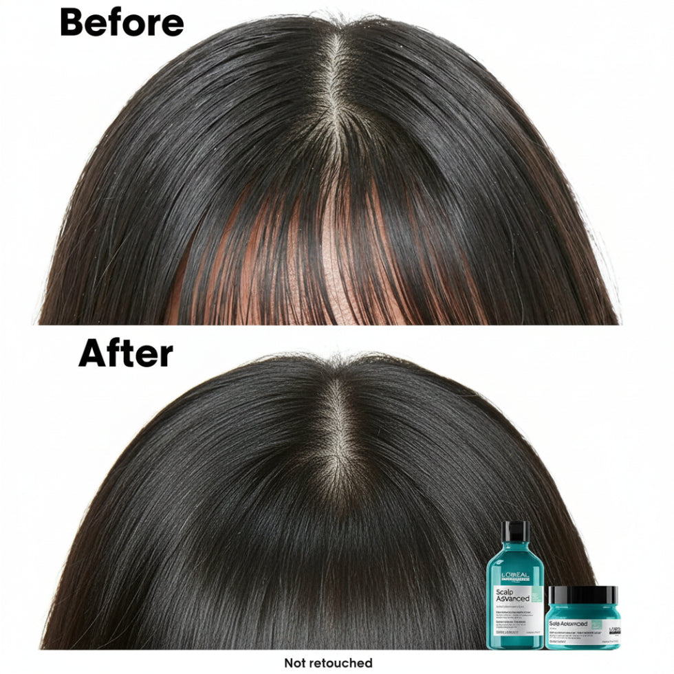 L’Oréal Professionnel Serie Expert Scalp Advanced Anti-Oiliness Dermo-Purifier Shampoo 500ml for oily scalp cleansing, sebum control, and professional scalp care.