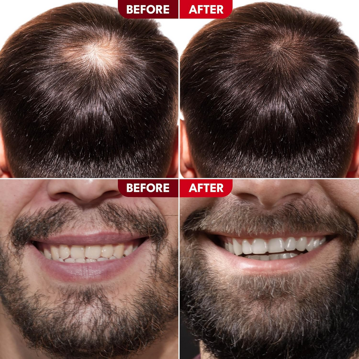 Tropic Isle Strong Roots Beard & Hair Oil 8oz | Red Pimento + JBCO Care